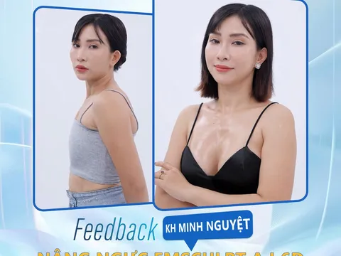 Tại Sao Nên Chọn Nâng Ngực Tại Viện Thẩm Mỹ Dr. Christian?