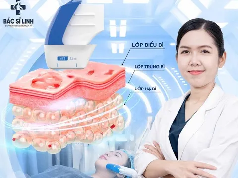 Khi cơ mặt xuống cấp sớm: vì sao nhiều người 30–40 tuổi tìm đến nâng cơ MPT