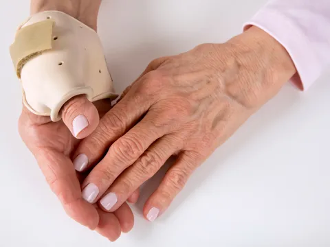 4 phương pháp cải thiện chức năng bàn tay