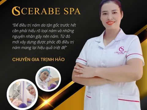 Chuyên gia Trịnh Hảo thực hiện điều trị nám chuẩn y khoa tại Cerabe Spa cơ sở 14