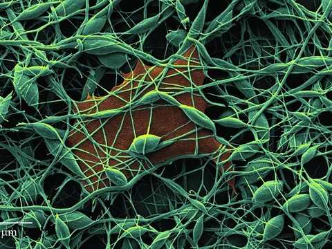 Băng y tế chứa kim cương giúp phát hiện nhiễm trùng