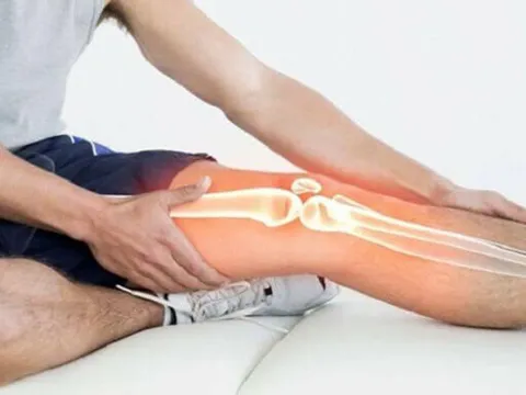 Đề phòng cứng khớp khi trở trời