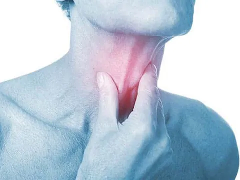 Viêm amidan, khi nào cần cắt?