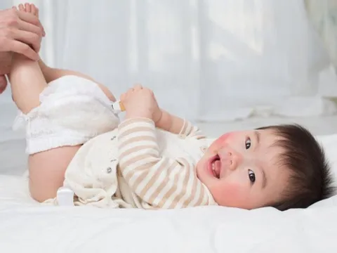 3 điều mẹ cần biết để ngăn ngừa và khắc phục hăm tã cho con