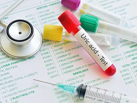 Hoàng Thống Phong – Giải pháp cải thiện bệnh gút hiệu quả từ thiên nhiên