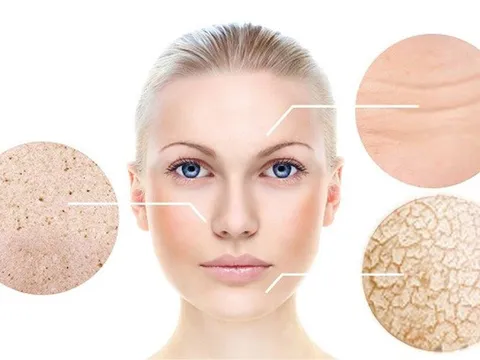 Phân biệt nám nội tiết tố và nám môi trường - đâu là giải pháp trị nám hiệu quả