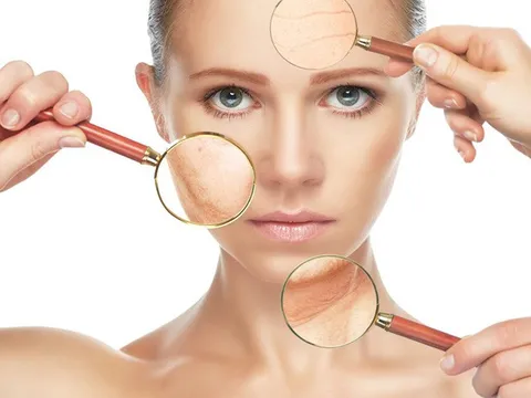 Cách nhận biết làn da bị lão hóa theo từng độ tuổi