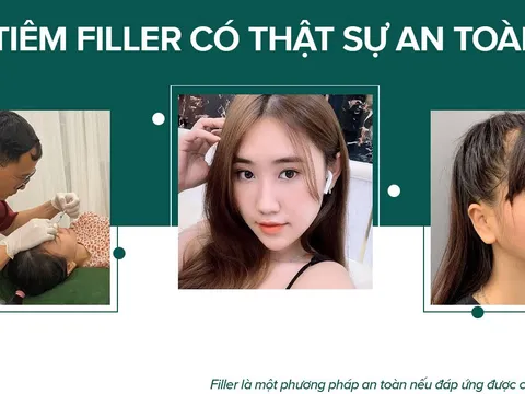Bác sĩ phẫu thuật thẩm mỹ nổi tiếng giải đáp về tính an toàn của Filler