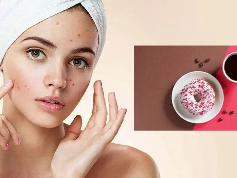 5 loại thực phẩm không tốt cho da