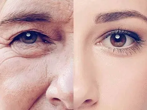 8 thói quen giúp tăng sinh collagen