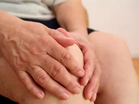 Bệnh viêm khớp gối và giải pháp cải thiện hiệu quả nhờ sản phẩm thảo dược