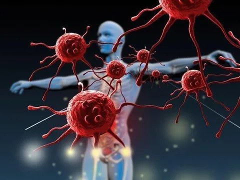 Thực phẩm bảo vệ sức khỏe Oncolysin - Giải pháp hỗ trợ giảm nguy cơ ung bướu