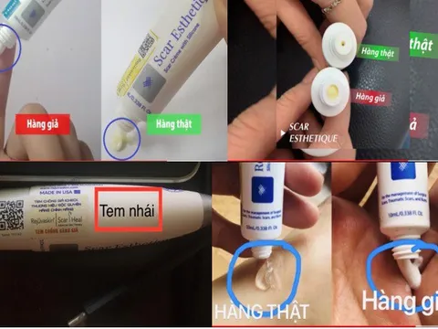 Kem trị sẹo Rejuvaskin – Phân biệt hàng thật/ hàng giả, đâu là sự thật