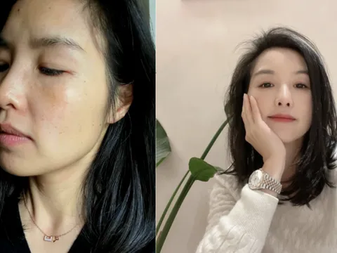 U40 “lột xác” ngoạn mục nhờ uống Collagen mỗi ngày