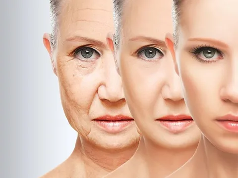 Căng da mặt không phẫu thuật tại Dr. Hoàng Nguyên: Sự lựa chọn siêu an toàn cho Việt Kiều