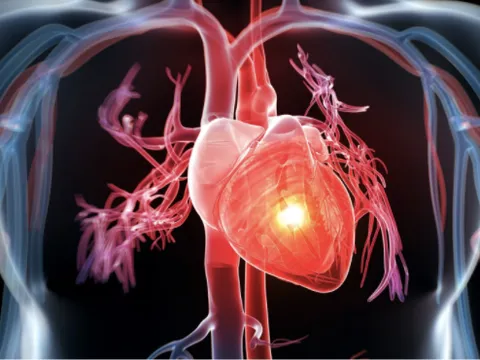 Tìm hiểu bệnh rối loạn nhịp tim và thuốc điều trị rối loạn nhịp tim